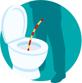 Blood in pee illustration