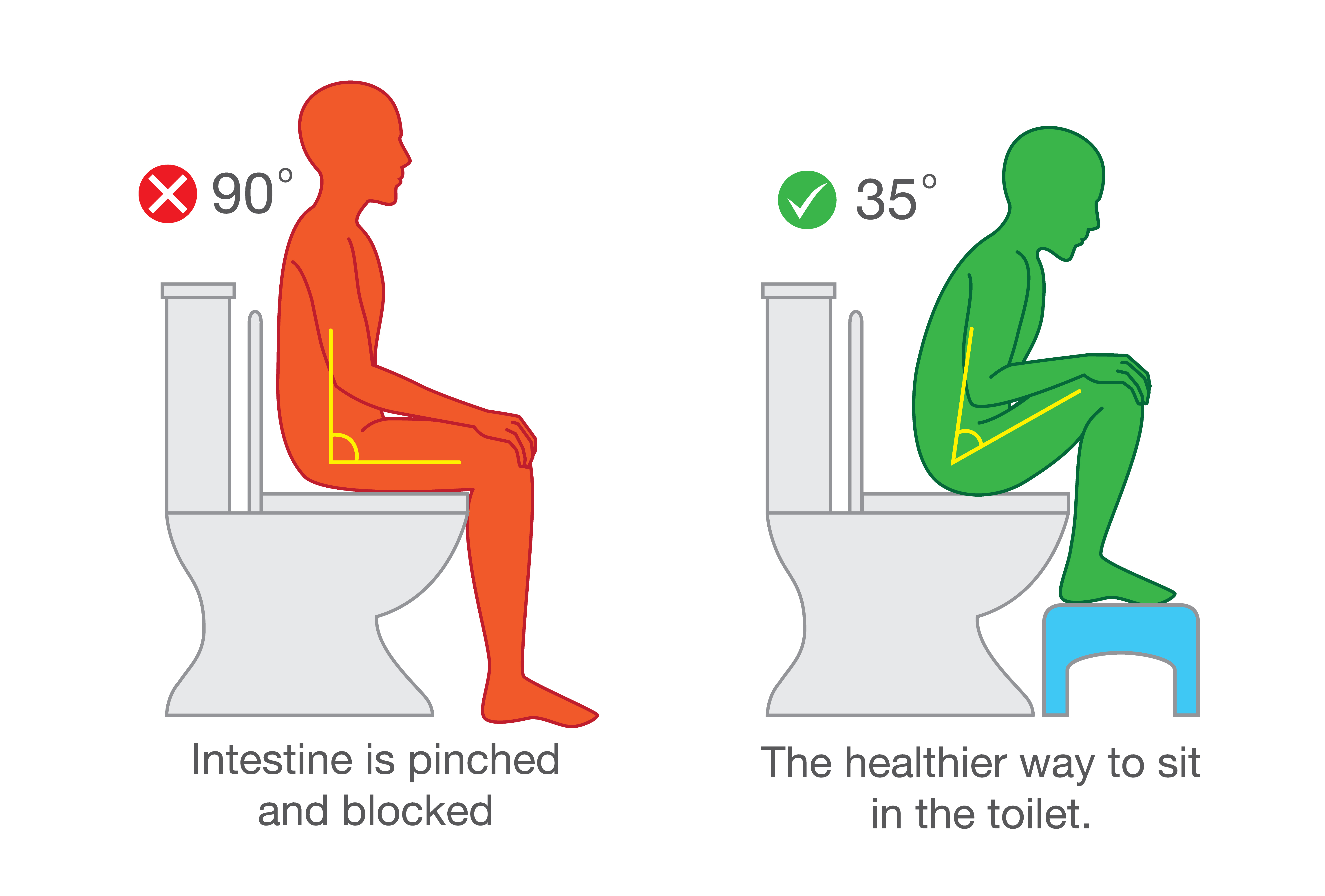 Toilet positioning